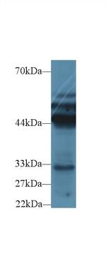 Cytokeratin 18 Antibody in Western Blot (WB)