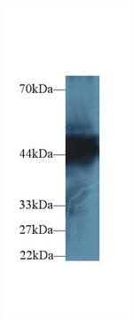Cytokeratin 18 Antibody in Western Blot (WB)
