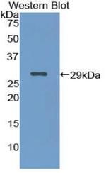 Cytokeratin 18 Antibody in Western Blot (WB)