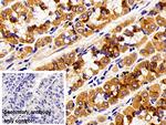 Cytokeratin 18 Polyclonal Antibody