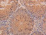 Cytokeratin 18 Antibody in Immunohistochemistry (Paraffin) (IHC (P))