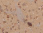 Cytokeratin 18 Antibody in Immunohistochemistry (Paraffin) (IHC (P))