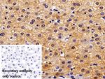 Cytokeratin 18 Antibody in Immunohistochemistry (Paraffin) (IHC (P))