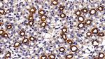 Cytokeratin 18 Antibody in Immunohistochemistry (Paraffin) (IHC (P))