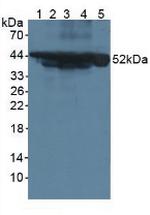 Cytokeratin 18 Antibody in Western Blot (WB)