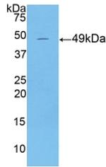 Cytokeratin 18 Antibody in Western Blot (WB)