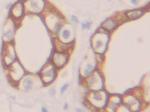 Cytokeratin 19 Antibody in Immunohistochemistry (Paraffin) (IHC (P))