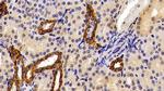 Cytokeratin 19 Antibody in Immunohistochemistry (Paraffin) (IHC (P))