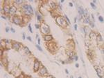 Cytokeratin 19 Antibody in Immunohistochemistry (Paraffin) (IHC (P))