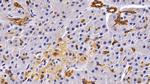 Cytokeratin 19 Polyclonal Antibody