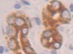 Cytokeratin 19 Antibody in Immunohistochemistry (Paraffin) (IHC (P))