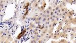 Cytokeratin 19 Antibody in Immunohistochemistry (Paraffin) (IHC (P))