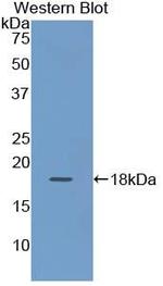 Cytokeratin 19 Antibody in Western Blot (WB)