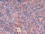 Cytokeratin 8 Antibody in Immunohistochemistry (Paraffin) (IHC (P))