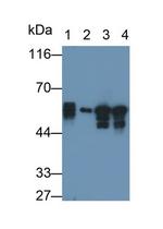 Cytokeratin 8 Antibody in Western Blot (WB)