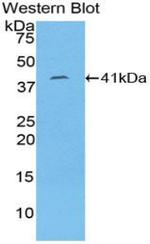 Cytokeratin 8 Antibody in Western Blot (WB)