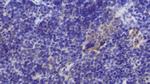 TRAIL-R2 (DR5) Polyclonal Antibody
