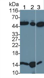 TRAIL-R2 (DR5) Antibody in Western Blot (WB)