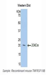 TRAIL-R2 (DR5) Antibody in Western Blot (WB)