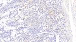 TRAIL-R2 (DR5) Antibody in Immunohistochemistry (Paraffin) (IHC (P))