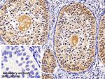 TRAIL-R2 (DR5) Antibody in Immunohistochemistry (Paraffin) (IHC (P))