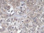DOCK4 Polyclonal Antibody