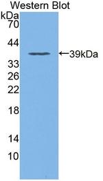 DOCK4 Antibody in Western Blot (WB)