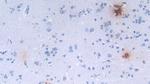 Defensin alpha-3 Antibody in Immunohistochemistry (Paraffin) (IHC (P))