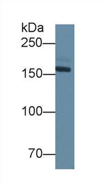 CD148 Antibody in Western Blot (WB)