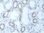 DLD Antibody in Immunohistochemistry (Paraffin) (IHC (P))