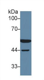 DLD Antibody in Western Blot (WB)