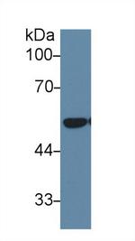 DLD Antibody in Western Blot (WB)
