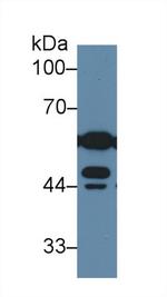 DLD Antibody in Western Blot (WB)