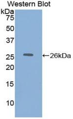 DLD Antibody in Western Blot (WB)