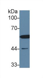 DLD Antibody in Western Blot (WB)