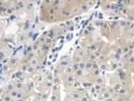 CTBS Polyclonal Antibody