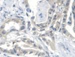 CTBS Antibody in Immunohistochemistry (Paraffin) (IHC (P))