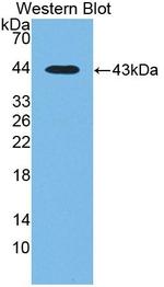 CTBS Antibody in Western Blot (WB)