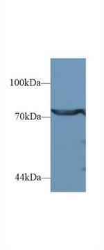 DPP3 Antibody in Western Blot (WB)