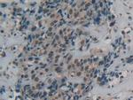 DbH Polyclonal Antibody