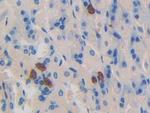 Dynamin 1 Polyclonal Antibody