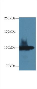 ENPP1 Antibody in Western Blot (WB)