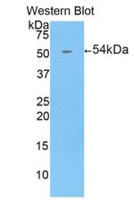 ENPP1 Antibody in Western Blot (WB)