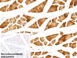 ENO1 Antibody in Immunohistochemistry (Paraffin) (IHC (P))