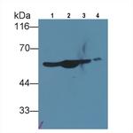 NSE Antibody in Western Blot (WB)