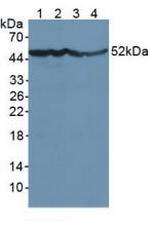 NSE Antibody in Western Blot (WB)