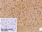 NSE Antibody in Immunohistochemistry (Paraffin) (IHC (P))