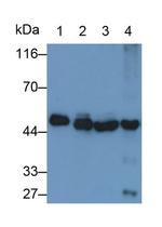 NSE Antibody in Western Blot (WB)