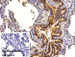 EpCAM (CD326) Antibody in Immunohistochemistry (Paraffin) (IHC (P))