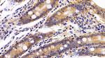 EpCAM (CD326) Antibody in Immunohistochemistry (Paraffin) (IHC (P))